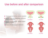 Kegel Trainer Electric Muscle Stimulation Incontinence Therapy Women Improve Intimate Sensation Vagina Tightening Women