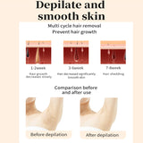 Permanent IPL Epilator Laser Hair Removal Electric Photo Women Painless Hair Remover Machine Epilator 990000 Flashes a Laser