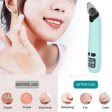 Pore Cleaner Blackhead Black Dot Remover Face Pore Vacuum Skin Care Black Head Removal Vacuum Suction Tools Blackhead Remover