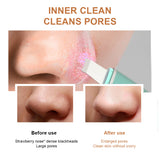 Ultrasonic Skin Scrubber Deep Face Cleaning Machine Peeling Shovel Facial Pore Cleaner Face Skin Scrubber Lift Machine