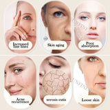 RF Injector Needle Free EMS Mesotherapy Gun Anti Wrinkle Water Injector MesoGun Meso Gun Rejuvenation Skin Care Facial Beauty