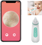 Baby Nose Cleaner Camera,Babies Nose Sucker Picker,Newborn Nasal Aspirator Otoscope APP Visualization On Mobile Phone