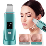 Ultrasonic Cleaner Skin Scrubber High Frequency Vibrator Skin Care Blackhead Remover Pore Deep Cleanse Skin Dirts Peeling Shovel