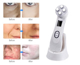 VIP Dropshipping RF EMS Micro-Current LED Phototherapy Beauty Device Eye Care Massager Dark Circle Wrinkle Removal Face Lifting