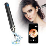 2022 New Intelligent Visual Ear Otoscope Led Light Wirelessly Portable Picker Ear Camera Inspection Tool Earwax Removal Otoscope