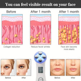EMS Face Massager RF Radio Mesotherapy Face Lifting Device LED Photon Therapy Wrinkle Removal Vibration Deep Cleansing Machine