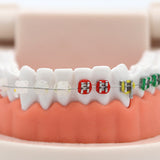 1pc Dental Orthodontic Treatment Model Typodont With Ortho Metal Ceramic Bracket Arch Wire Orthodontic Toothed Denture Model