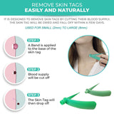 2-4MM/4-8MM Skin Tag Removal Kit Skin Mole Wart Remover Micro Band Skin Tag Removal Kit with Cleaning Pads Mole Face Care