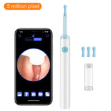 Wireless Ear Cleaner Wax Removal Tool Intelligent Visual 3.9mm Luminous Endoscopy High-definition Otoscope  Ear Picking Spoon