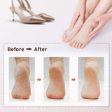 Electronic Feet File Hard Skin Callus Remover Scrubber Home Pedicure Exfoliation Tool Rechargeable Foot care tools @ME88