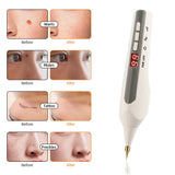 9 Levels Point Needle Remover Pen Facial Skin Black Spot Body Wart Tag Mole Freckle Tattoo Eraser Pen Laser Plasma Pen Recharge