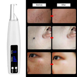 Machine Mole Removal Safe Tattoo Scar Pigment Light Therapy Professional Skin Care USB Rechargeable Picosecond Pen Freckle