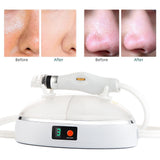 Portable Spray Water Injection Hydro Jet Beauty Machine Vacuum Suction Blackhead Clean Skin Rejuvenation Oxygen Small Bubbles