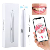 Ultrasonic Visual Scaler Electric Dental Teeth Cleaner Oral Care For Calculus Coffee Stain Plaque Tartar Remover Teeth Whitening