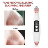 Electric Blackhead Remover Vacuum Face Ance Pore Cleaner Ultrasonic Skin Scrubber Pimple Black Head Suction Facial Washing Tools
