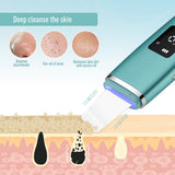 Ultrasonic Cleaner Skin Scrubber High Frequency Vibrator Skin Care Blackhead Remover Pore Deep Cleanse Skin Dirts Peeling Shovel