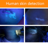 Lightweight Hand-Held Wood's Lamp Wavelength Ultraviolet Diagnostic UV Skin Fungal Detection Analyzer +flashlight Function