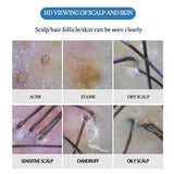 Wireless APP WIFI Skin Hair Follicles Scalp Detector 200X Digital Skin Analyzer Hair Salon Skin Hair Tester Microscope 2022 NEW
