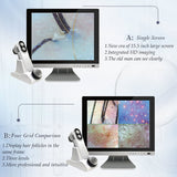 15 Inch 16G Professional Scalp Hair Follicle Oil Moisture Magnifying Detector Analyzer Skin UV Pigment Tester Hair Treatment