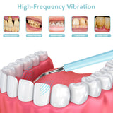 Dental Scaler Tooth Calculus Remover Ultrasonic Tooth Cleaner Tartar Remover Dental Tool Set High Frequency Teeth Whitening Tool