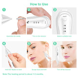 Beauty Equipment Laser Freckle Remove Moles Beauty Equipment Facial Beauty Tools