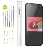 Wireless Otoscope Earwax Removal Camera, ScopeAround Digital Otoscope Ear Cleaner, 1080 HD Ear Camera with 6 LED Lights