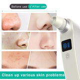 Blackhead Remover Visual Face Deep Cleaner USB Rechargeable Electric Facial Pore Cleanser Vacuum Facial Beauty Skin Care Tool