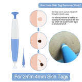 Non Toxic Auto Band Face Care Mole Wart Tool For Small To Medium Blue Skin Tag Removal Kit With Cleansing Swabs Home Use Adult
